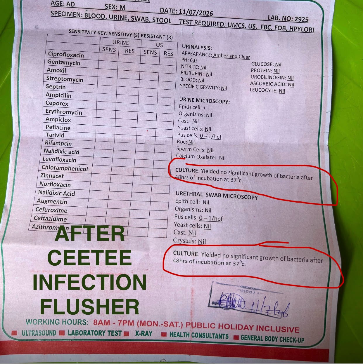 Customer test result before starting CEETEE Infection Flusher