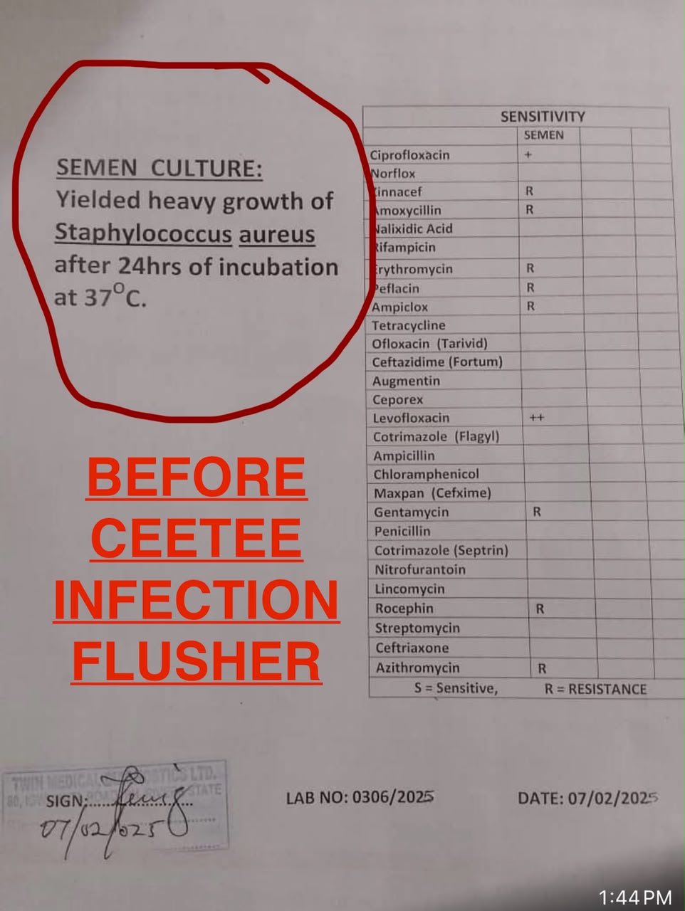 Customer test result after completing CEETEE Infection Flusher